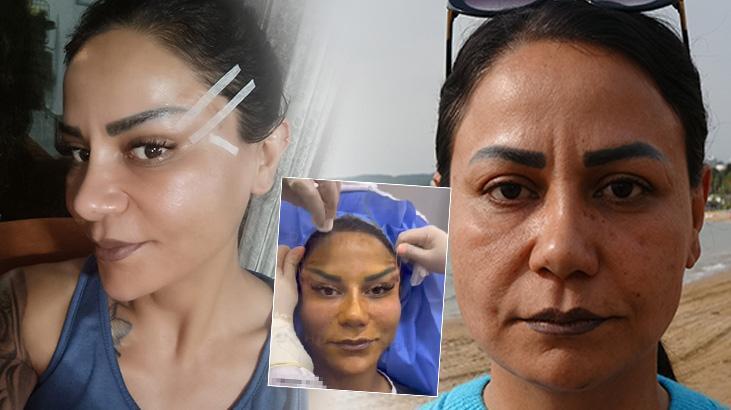 220 bin TL’lik estetik kabusu: Vadettikleri yüzü ve günleri asla kullanmadım