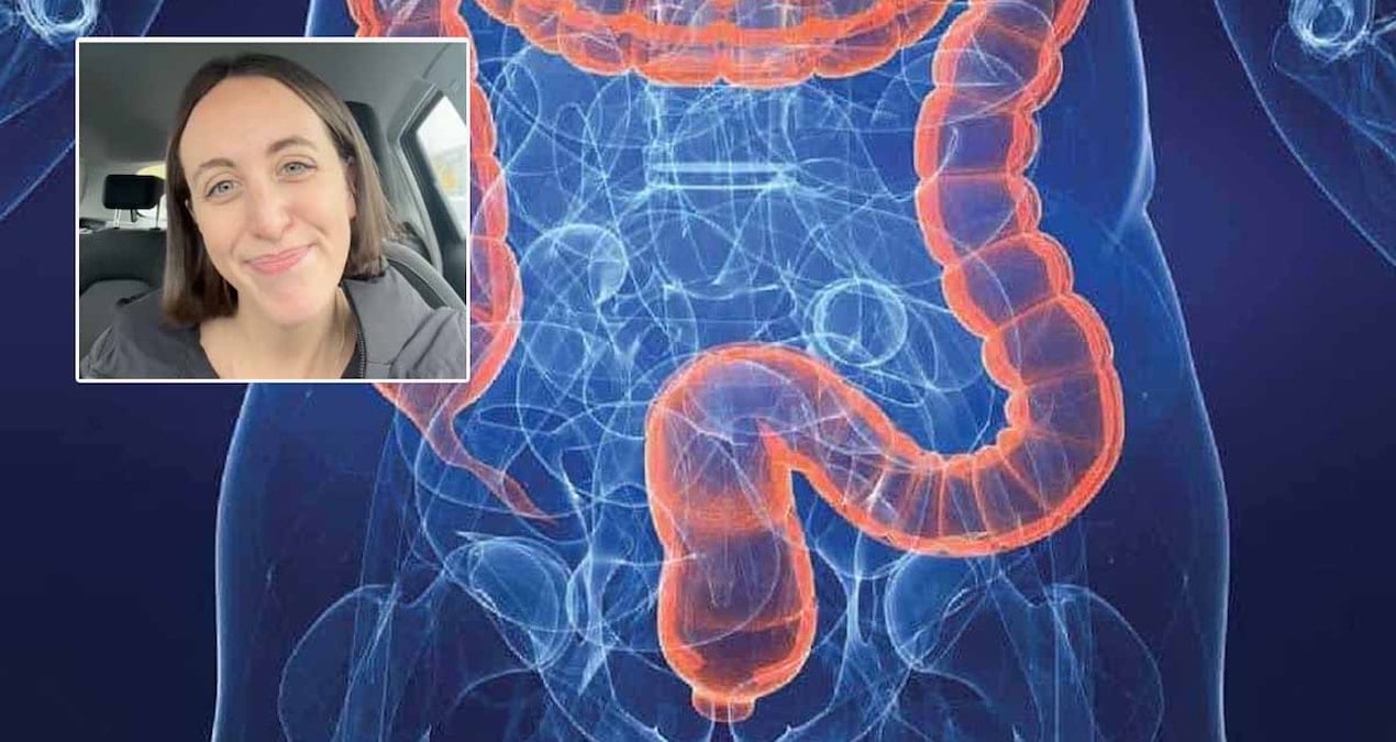 henuz 25 yasinda kolon kanserine yakalandi bana olmaz demeyin diyerek kendisinde gordugu 4 belirtiyi siraladi p4T2asuX